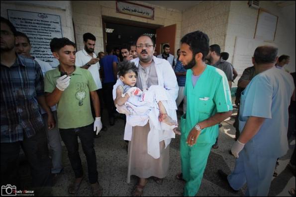 Girl being evacuated from Aqsa-Martyrs Hospital after being hit by Israel tanks, On July 22, 2014, on Gaza, Palestine (photo/Shady Alassar)